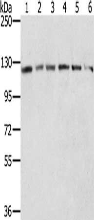 RNF20 Antibody