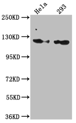 RNF20 Antibody