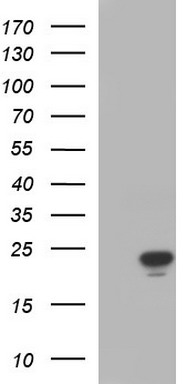 TRIM39 Antibody