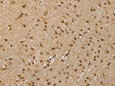 RNH1 Antibody