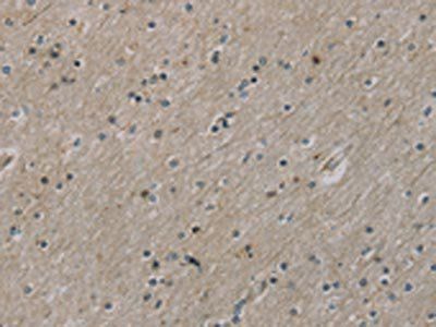 ROBO4 Antibody