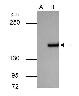 ROCK1 antibody [N1N2], N-term
