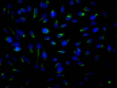 ROCK2 Antibody