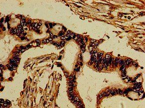 ROR2 Antibody