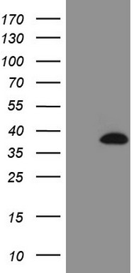 ROS1 Antibody