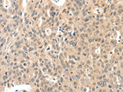 ROS1 Antibody