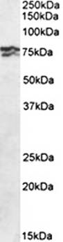 RPA1/RPA70 (aa323-337) Antibody