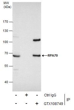 replication protein A1 Antibody