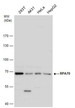 replication protein A1 Antibody