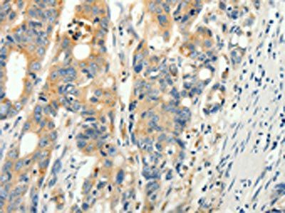 RPAP3 Antibody