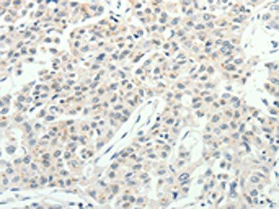 RPAP3 Antibody