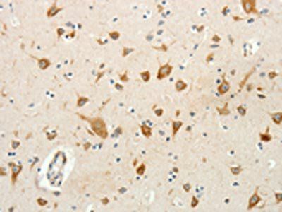 RPAP3 Antibody