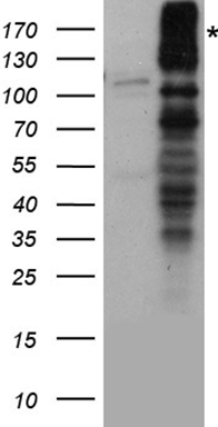 POLR2J Antibody