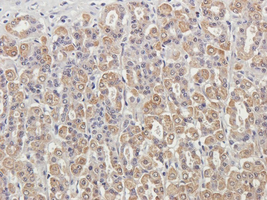 RPL10A Rabbit Polyclonal Antibody