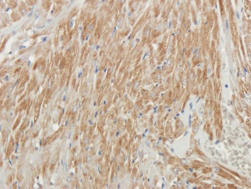 RPL10A Rabbit Polyclonal Antibody