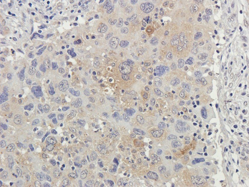 RPL10A Rabbit Polyclonal Antibody