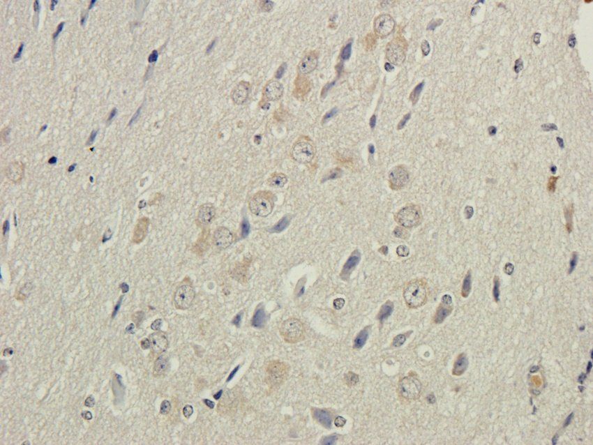 RPL10A Rabbit Polyclonal Antibody