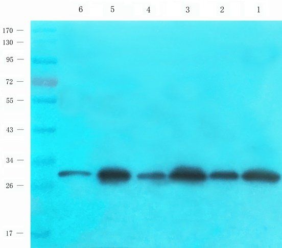 RPL10A Rabbit Polyclonal Antibody