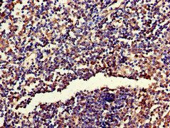 RPL19 Antibody