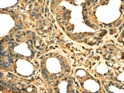 RPS3 Antibody