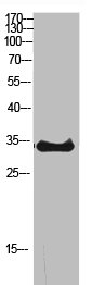 RPS6 Antibody