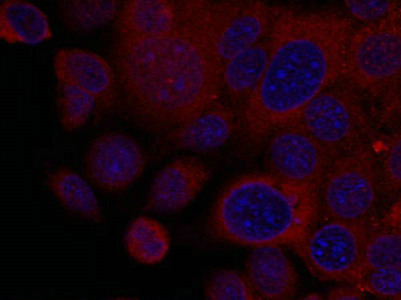 RPS6KB1 Antibody