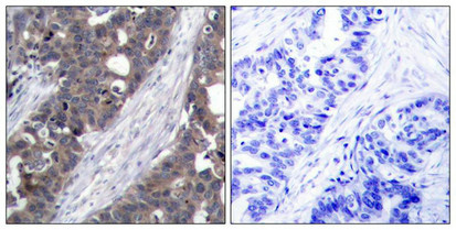 RPS6KB1 Antibody