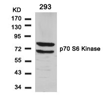 RPS6KB1 Antibody