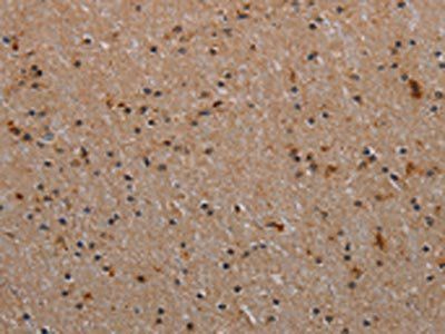 RPS6KB2 Antibody
