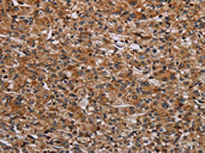 RPS6KB2 Antibody