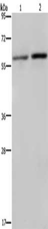 RPS6KB2 Antibody