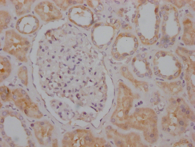 RPTOR Antibody