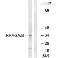 RRAGA/RRAGB Antibody