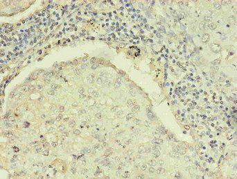 RRM1 Antibody