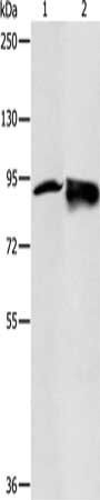 RRM1 Antibody