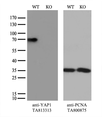 RRM2 Antibody