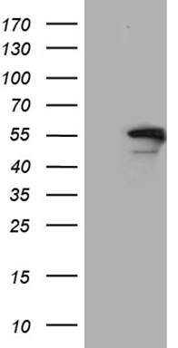 RRM2 Antibody