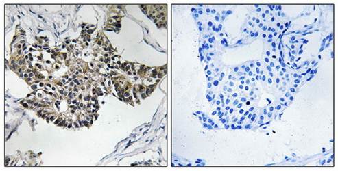 RSAD1 Antibody