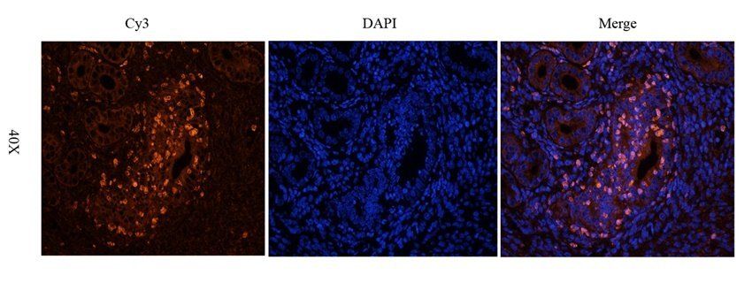 RYR2 Rabbit Polyclonal Antibody