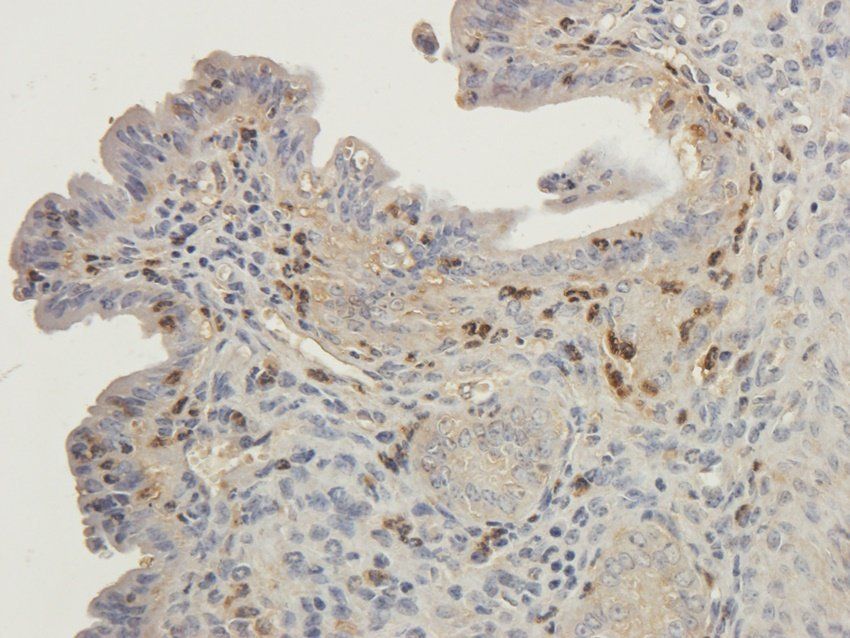 RYR2 Rabbit Polyclonal Antibody