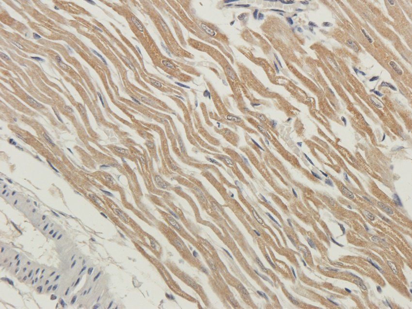 RYR2 Rabbit Polyclonal Antibody
