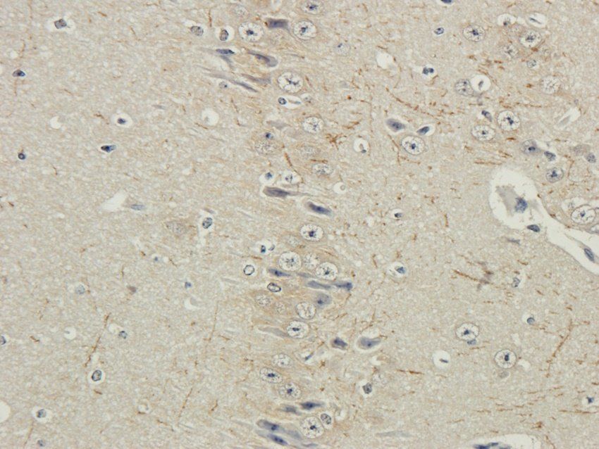 RYR2 Rabbit Polyclonal Antibody