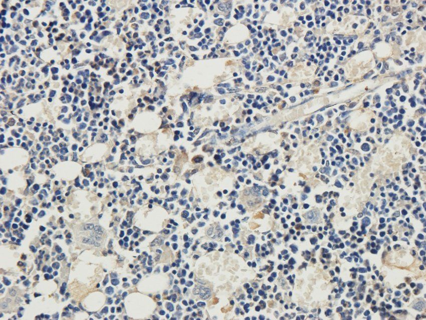 RYR2 Rabbit Polyclonal Antibody
