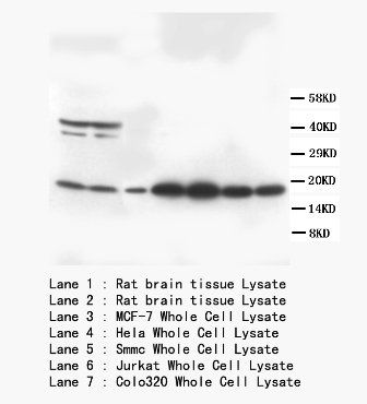 S100 beta/S100B Rabbit Polyclonal Antibody
