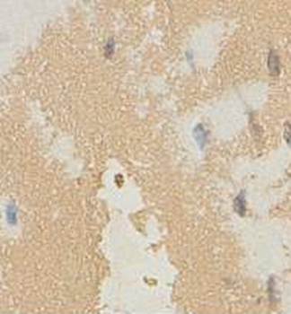 S100A2 Rabbit Polyclonal Antibody