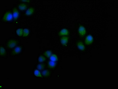 S100A7 Antibody