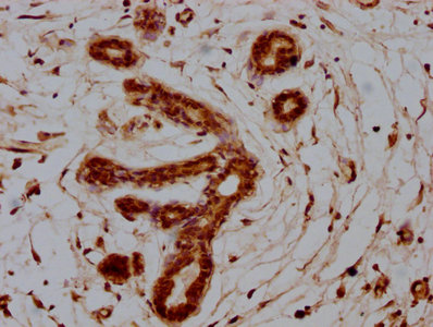 S100A7 Antibody