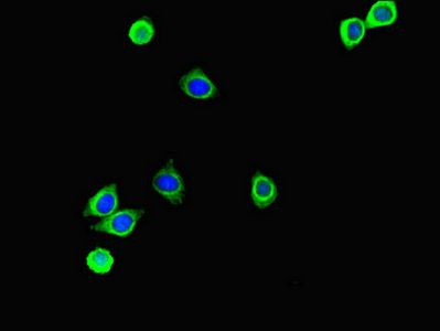 S100P Antibody