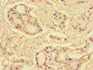 S100P Antibody