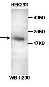 S100P Rabbit Polyclonal Antibody